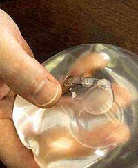 Sanidad advierte de los riesgos que implican los implantes mamarios