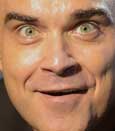 El Dr. Junco aclara dudas acerca del btox a raz de las declaraciones de Robbie Williams