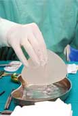 Un extrao tipo de cncer podra estar vinculado a los implantes mamarios