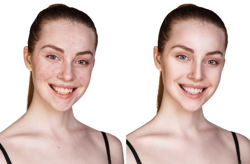 Una piel fotodañada necesita protocolos after sun de última generación
