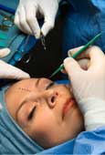 España ocupa el puesto 12º del ranking mundial en operaciones de cirugía estética