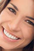 Flash Smile, para impactar con una sonrisa deslumbrante