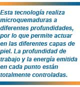 HIFU de Med-Apolo